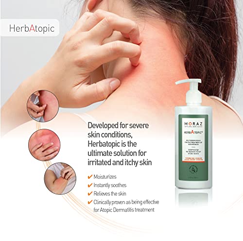Moraz bőr saver kenőcs, illetve bőrkiütés krém| Hidratálja, Táplálja, & Biztosítja a tápanyagok, hogy megvédjük a Bőrt |Végső Bőr Care