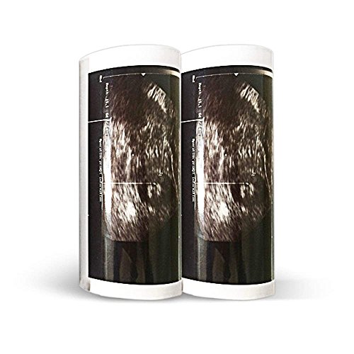 Sony Fekete-Fehér Termikus Papír, Normál Sűrűség, 10 tekercs/bx