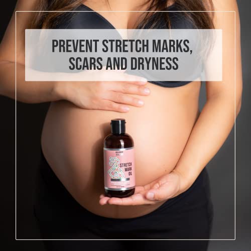 Magnum Vigaszt Stretch Mark Olaj Terhesség – - ban Természetes Has Olaj a Terhesség, a kakaóvaj Olaj, Mandula Olaj, a Bőr –